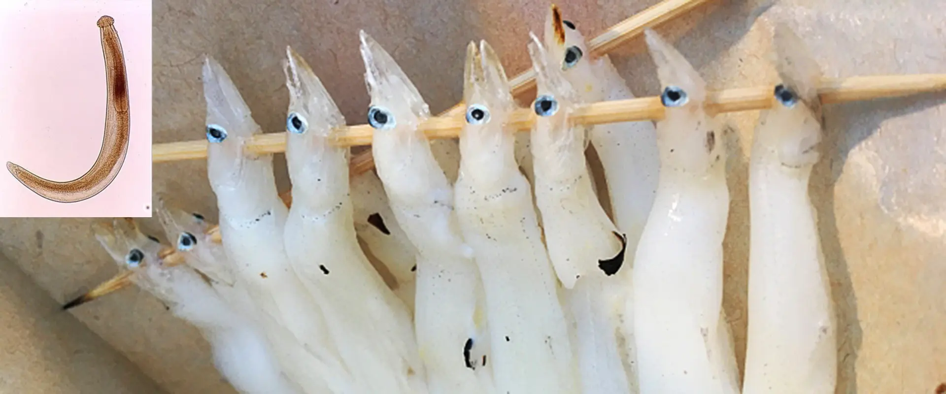 どんな寄生虫？症状は？