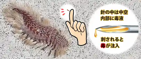 毒針はどこ