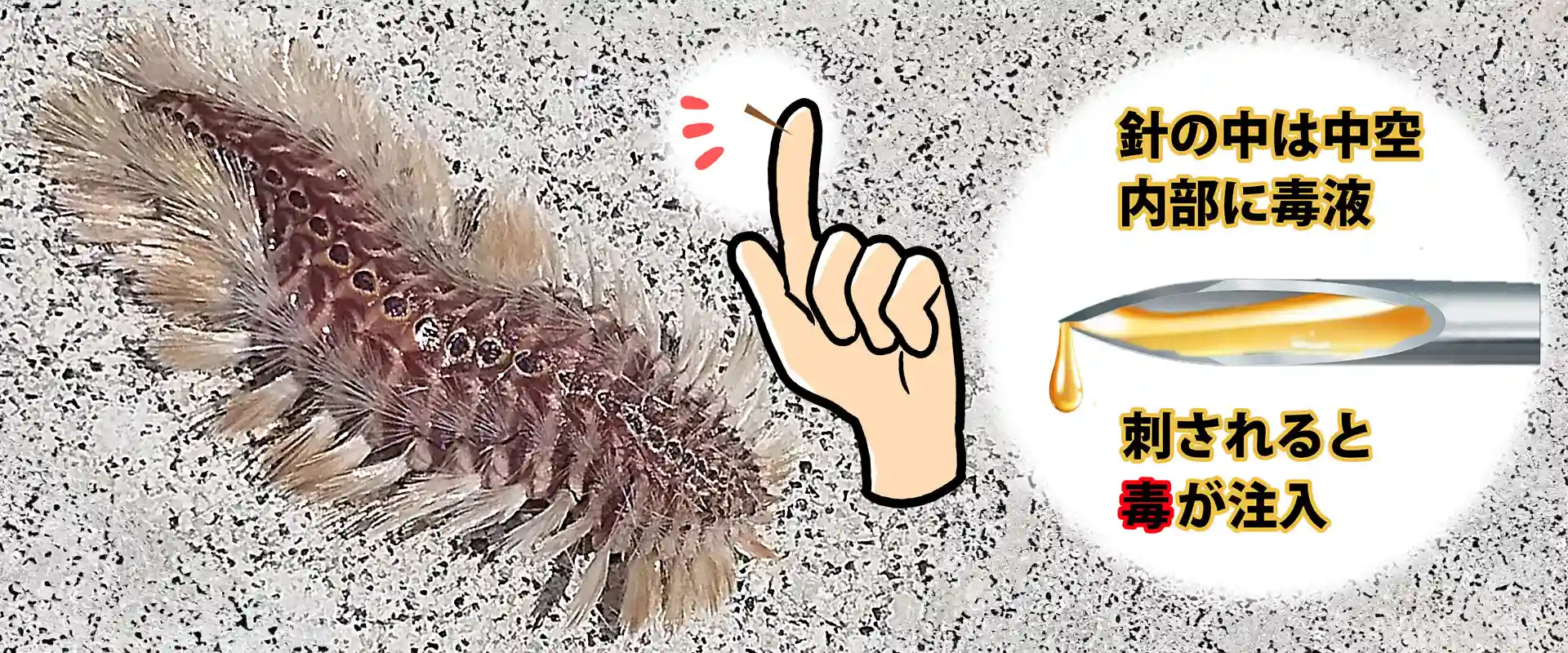 毒針はどこ